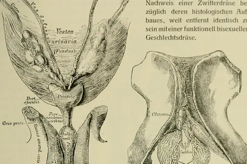 Map: Hermaphroditismus Beim Menschen 1908 14597140957
