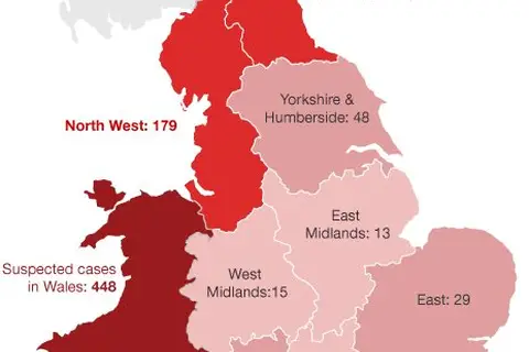 Map: Lab Confirmed Cases of Measles in the Current UK Outbreak