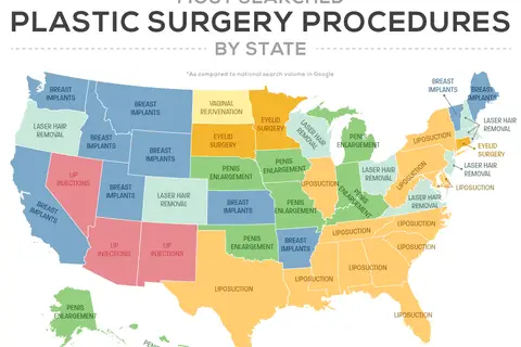 Map: Most Searched Popular Surgery Procedures by State