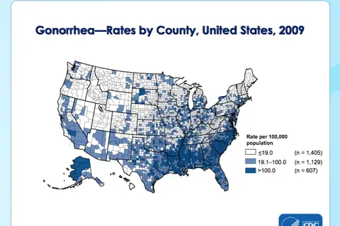 Map: Rates of Gonorrhea Infections by U.S. County, 2009